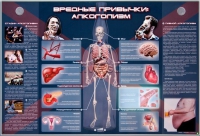 Электрифицированный стенд "Вредные привычки: алкоголизм" - «globural.ru» - Салехард
