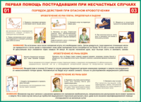 Таблица Порядок действий при опасном кровотечении 1000*1400 винил - «globural.ru» - Салехард