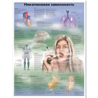 Плакат "Никотиновая зависимость", ламинированный, 50*67 см - «globural.ru» - Салехард